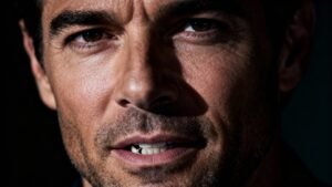 Kelly Ripa: “His Face Changed!” Mark’s Missing Tooth