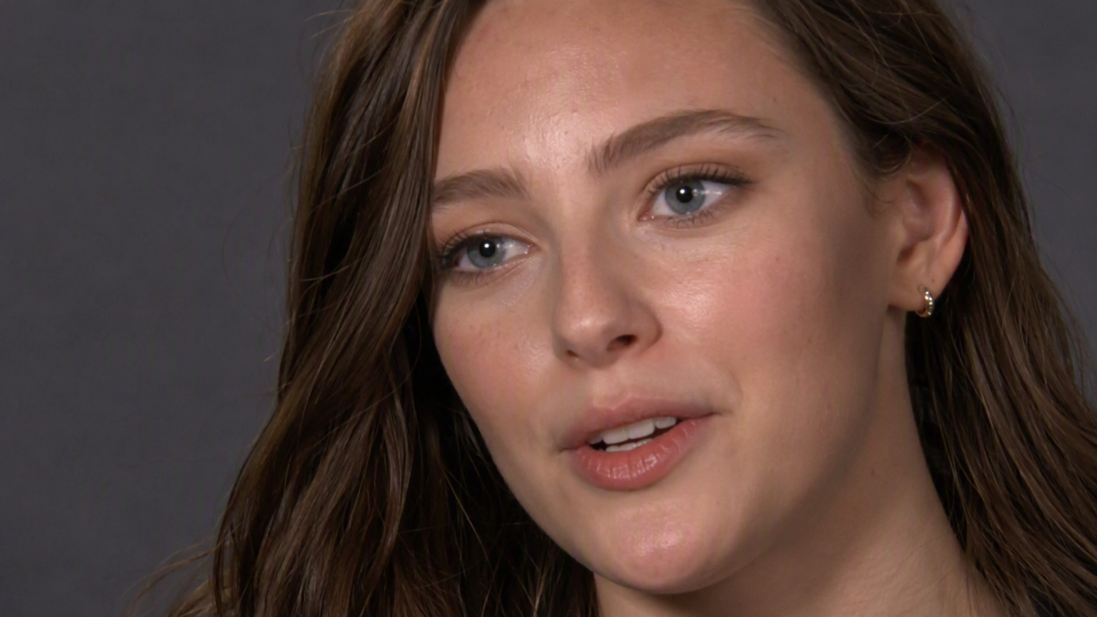 Jennifer Lawrence's Botox Secret: 